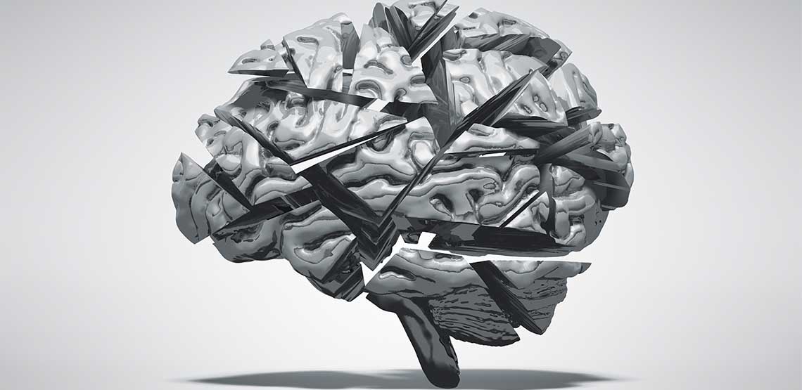 A grey graphic of a brain.